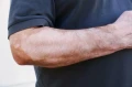 bielactwo.jpg.webp