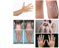 fototerapia dvf32.png